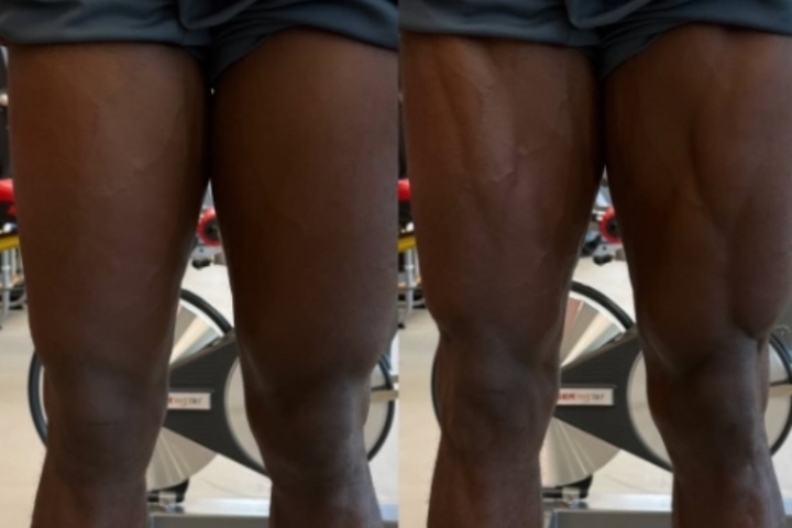 体育创新-重伤归来！阿方索晒照自己腿部的变化，轻松练出肌肉